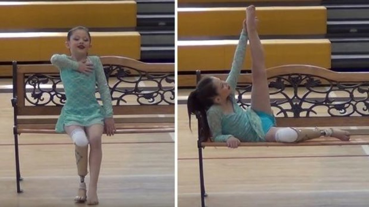 Ihr erster Tanz mit dem neuen Bein nach einer Beinamputation