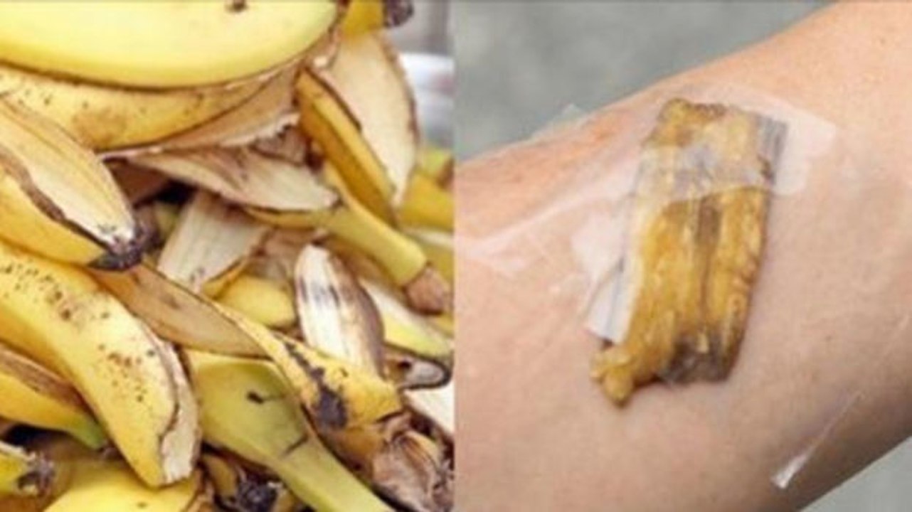 GENIAL! Entdecke, was du alles mit einer Bananenschale machen kannst!