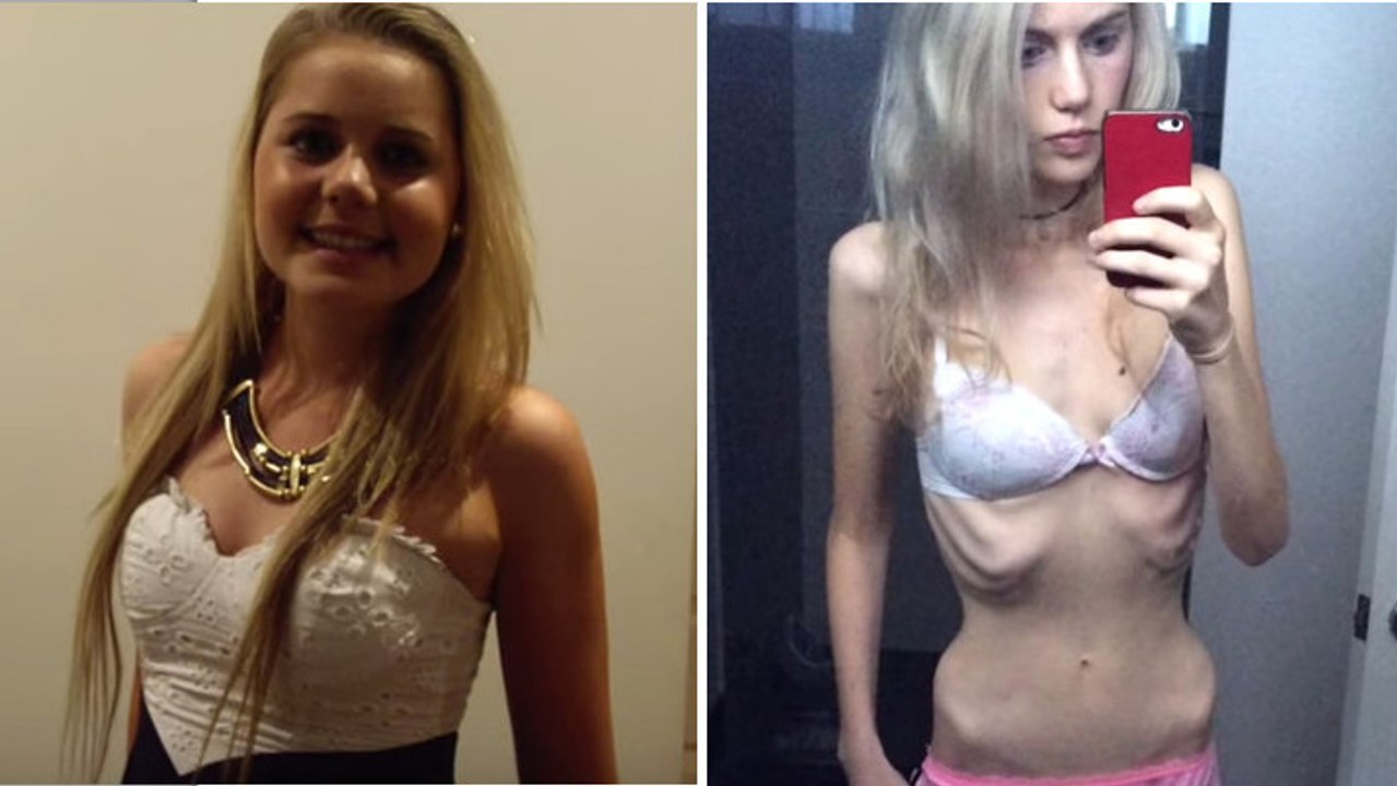 Alles fing mit einer Abmagerungskur an... doch nach und nach war es die Hölle!