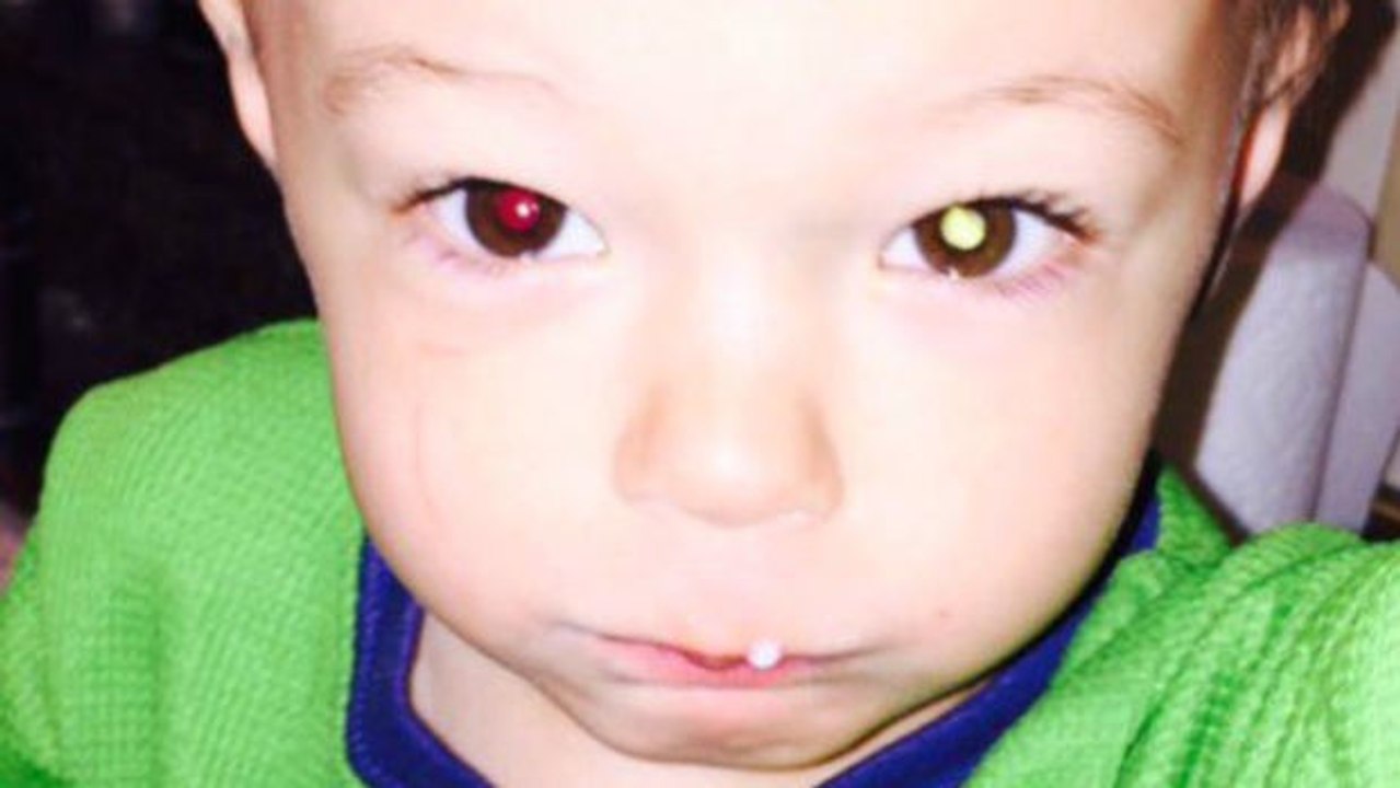 Eine Mutter entdeckt anhand eines Fotos, dass ihr Kind Krebs hat