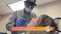 Gasser Dental Implants: How they are 