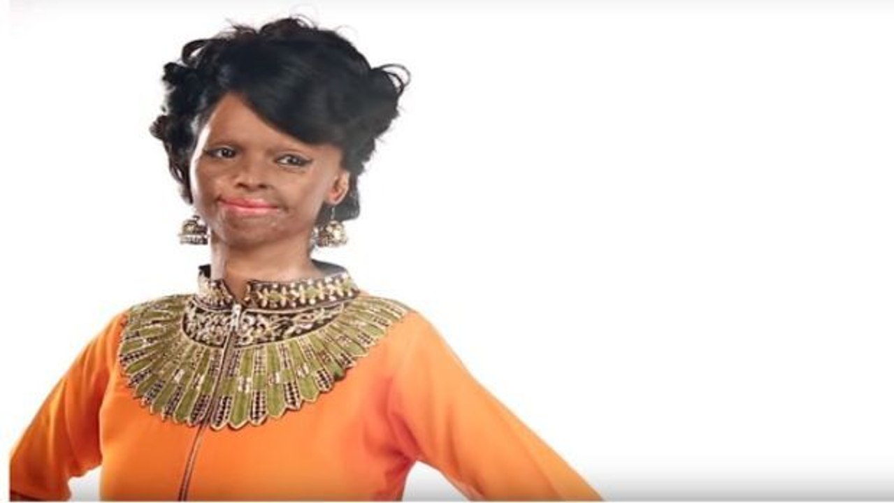 Indien: Ihr durch einen Säureangriff entstelltes Gesicht wird Teil einer Modekampagne