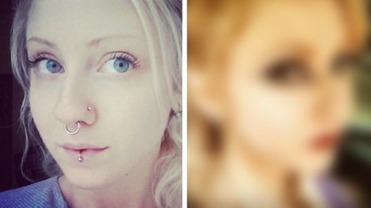 Sie unterzog sich einer Gesichts-OP, um auszusehen wie eine Elfe