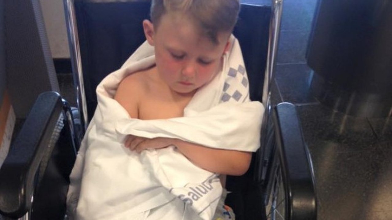 Mutter warnt Eltern vor Badehosen, nachdem sich ihr Sohn schwer verletzt