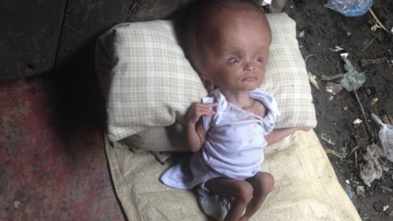 Sie findet ein schwer vernachlässigtes Kind in Unrat und Trümmern... Entdeckt mit uns seine unglaubliche Verwandlung!