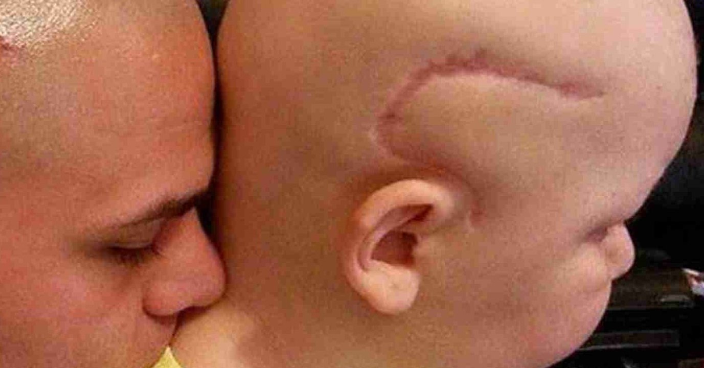 Er lässt sich eine Narbe wie bei seinem Sohn tätowieren!