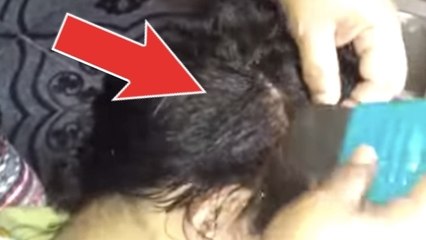 Läuse überall in den Haaren ihres Sohnes!