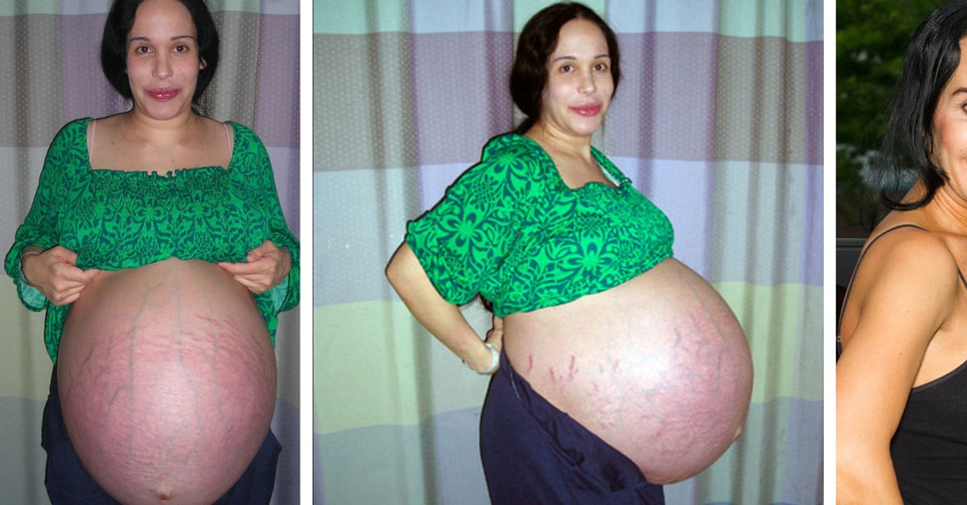 Natalie Suleman: Was wurde aus Octomom, der Doppelgängerin von Angelina Jolie und Mutter von Achtlingen?