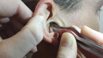 Pfropfen im Ohr: Mit welchen Mitteln du ihn entfernen kannst - und was du nicht tun solltest