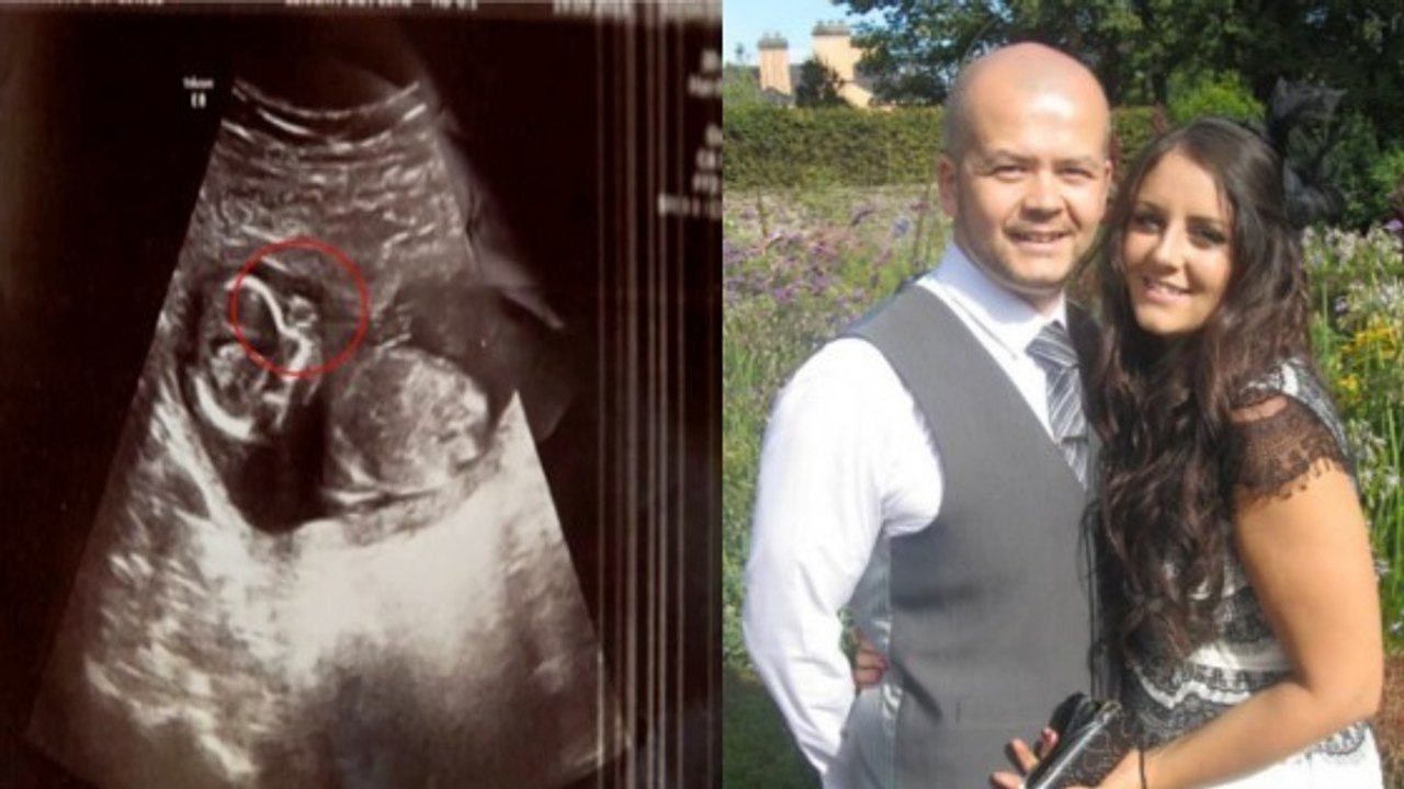 Diese Frau ist schwanger nach einer Fehlgeburt mit Abtreibung