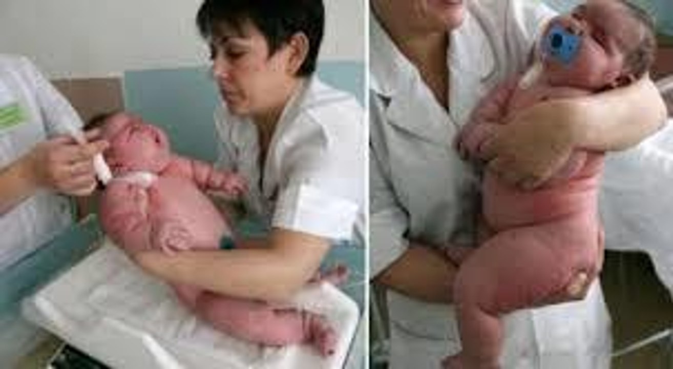 Dieses baby ist das schwerste baby der welt und wiegt 18 kilo!
