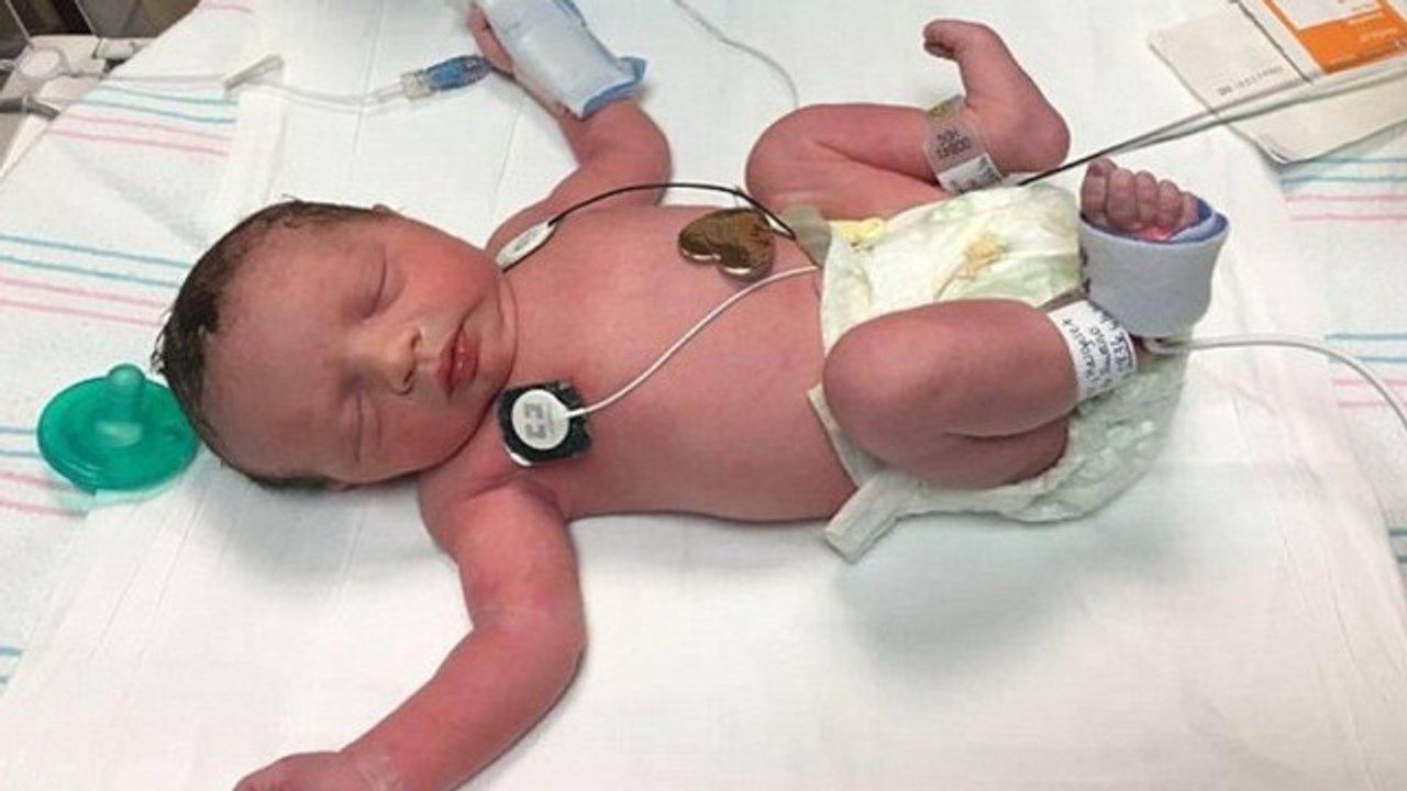 Mit diesem Baby hat es etwas ganz besonderes auf sich! Ihr werdet es nicht glauben!