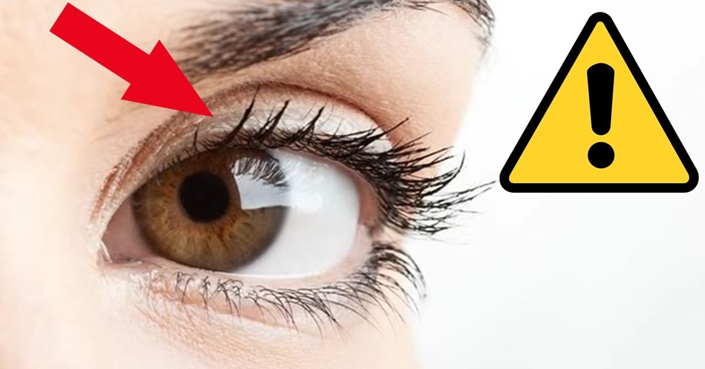 Augenzucken: Symptome, Faktoren und Behandlung