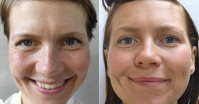 Sie trinkt vier Wochen lang fast vier Liter Wasser am Tag. Was mit ihrem Körper passiert, ist erstaunlich!