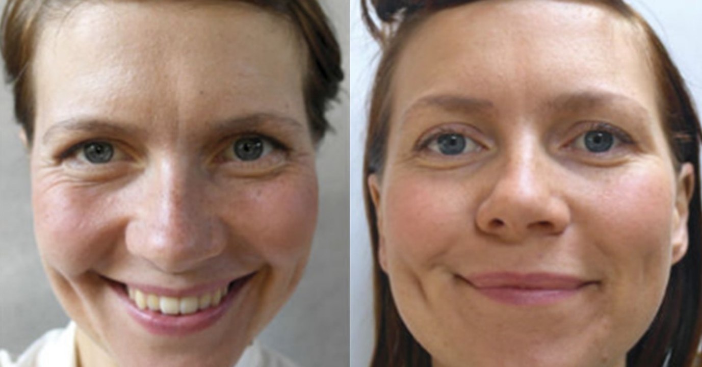 Sie trinkt vier Wochen lang fast vier Liter Wasser am Tag. Was mit ihrem Körper passiert, ist erstaunlich!