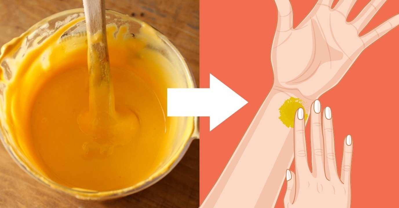 Kurkuma hat positive Auswirkungen auf die Haut