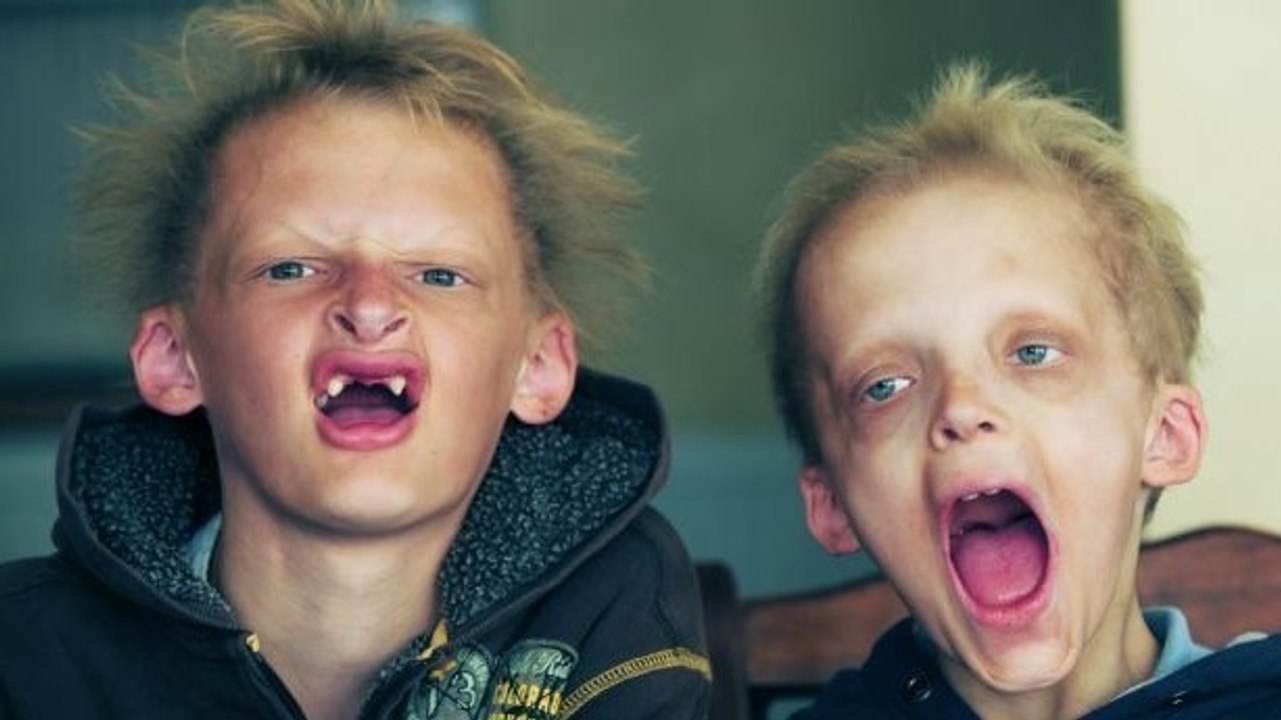 Die gruselige Geschichte der Vampir-Kinder