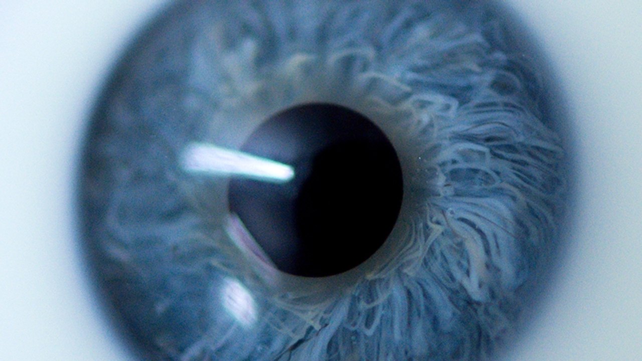 Mouches volantes: Die Augenkrankheit, die für viel Leid sorgt