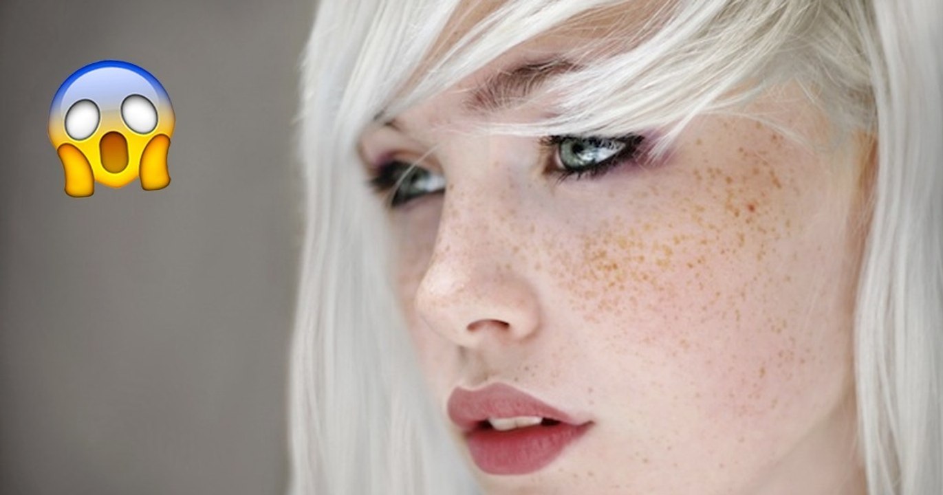 Der neueste Tattoo-Trend: falsche Sommersprossen