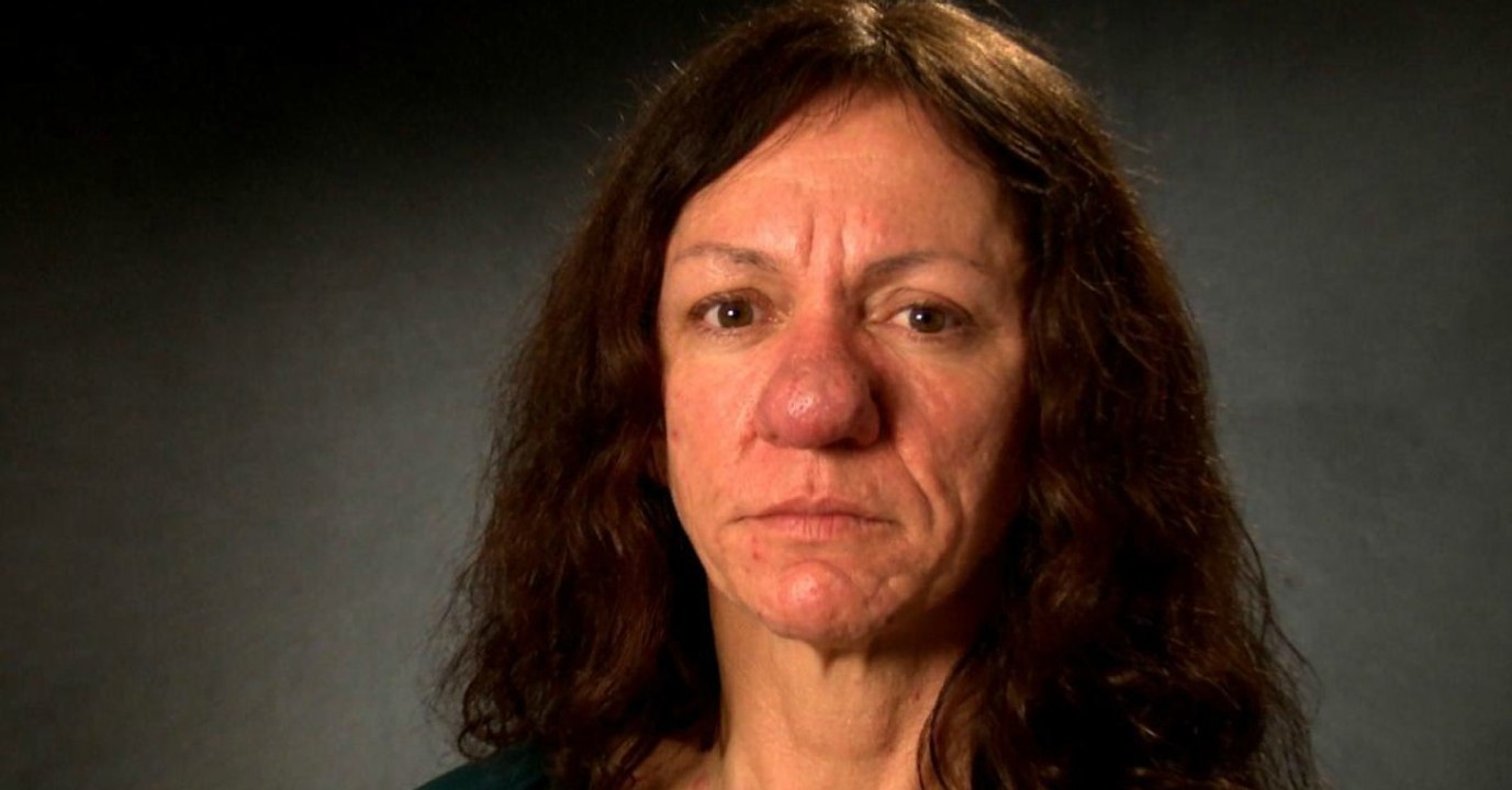 Pamelas Nase wächst seit Jahren völlig unkontrolliert. Heute sieht sie ganz anders aus!