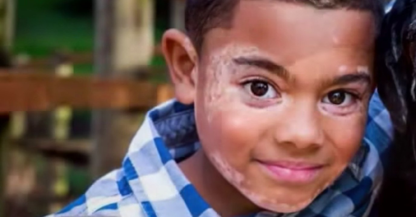 Carter leidet an Vitiligo und schämt sich dafür. Doch dann tritt ein ganz besonderes Fellknäuel in sein Leben und....