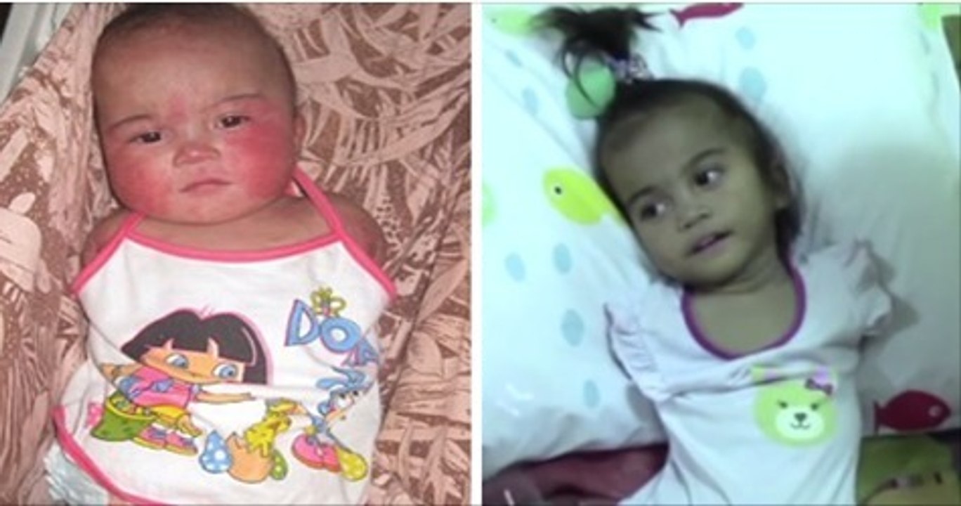 Dieses kleine Mädchen kommt ohne Arme und Beine zur Welt...Doch dann nimmt ihr Schicksal eine unerwartete Wende!