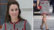 Kate Middleton: Internetnutzer sehen ein Geistergesicht auf ihrem Knie