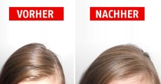 Fettige Haare loswerden: Mit diesen Tricks klappt es!