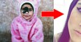 Mariana Mendes: Diese junge Frau mit einem Muttermal im Gesicht macht daraus ihr Markenzeichen