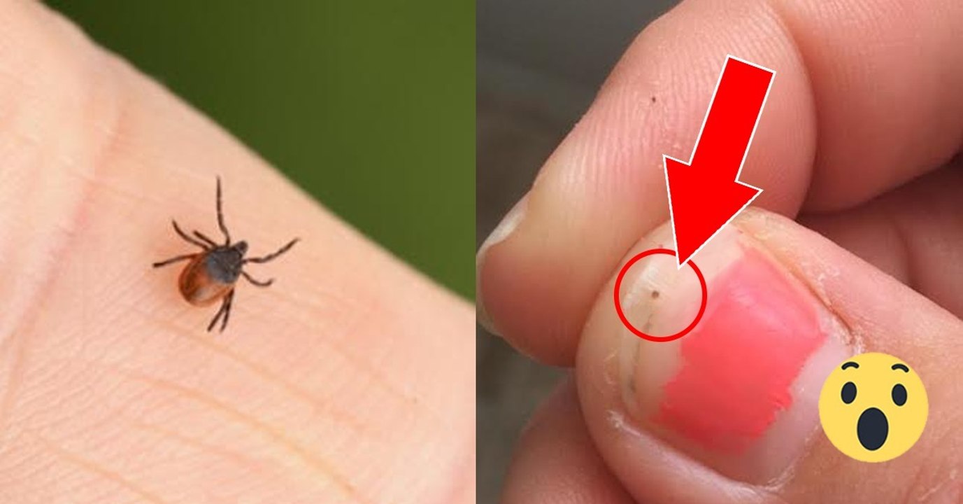 Zeckenlarven: So gefährlich sind die kleinen Biester