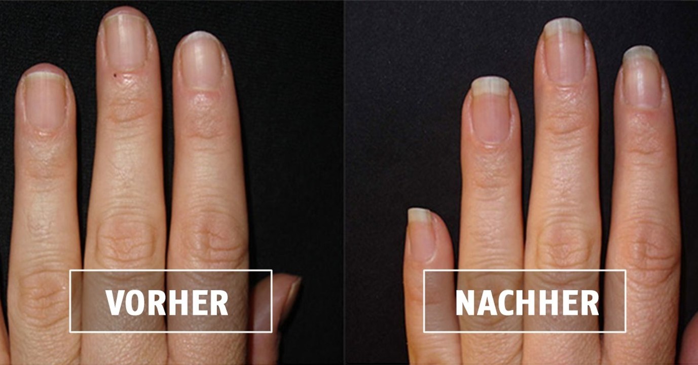 Maniküre: Dieses selbstgemachte Nagelbad lässt deine Nägel schneller wachsen