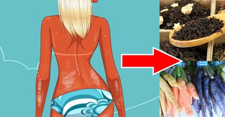 Selbstbräuner selbst gemacht: So geht es!