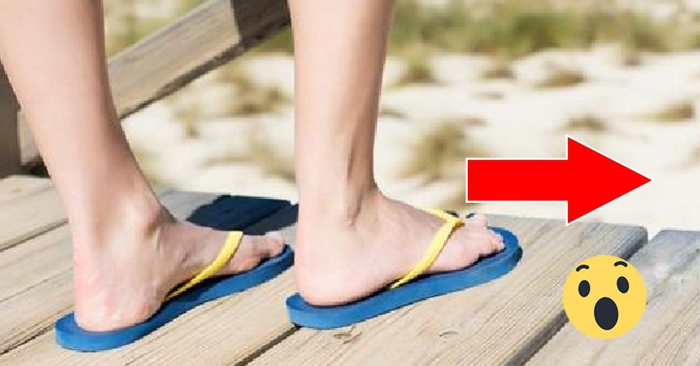 Flip-Flops: Gesundheitliche Risiken für die Füße