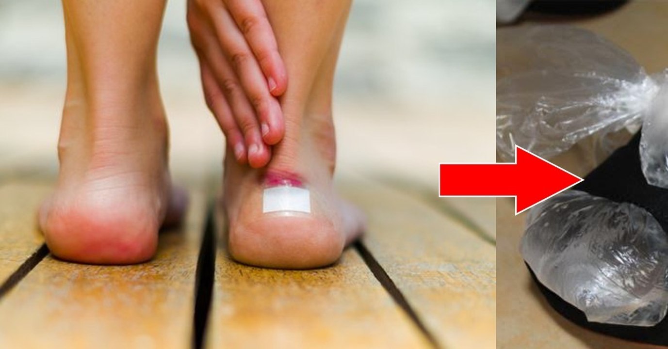 Neue Sandalen? Mit diesen Tipps musst du dir keine Sorgen mehr um Schrammen und Blasen machen!