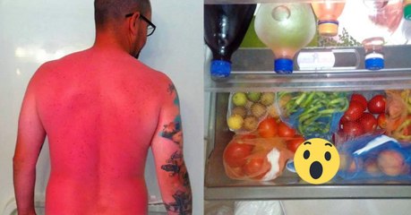 Er legt eine Scheibe davon auf seine verbrannte Haut und sein Sonnenbrand verschwindet fast vollständig