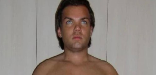 Nach 47 Schönheitsoperationen: Diesen Mann gibt es so nicht mehr