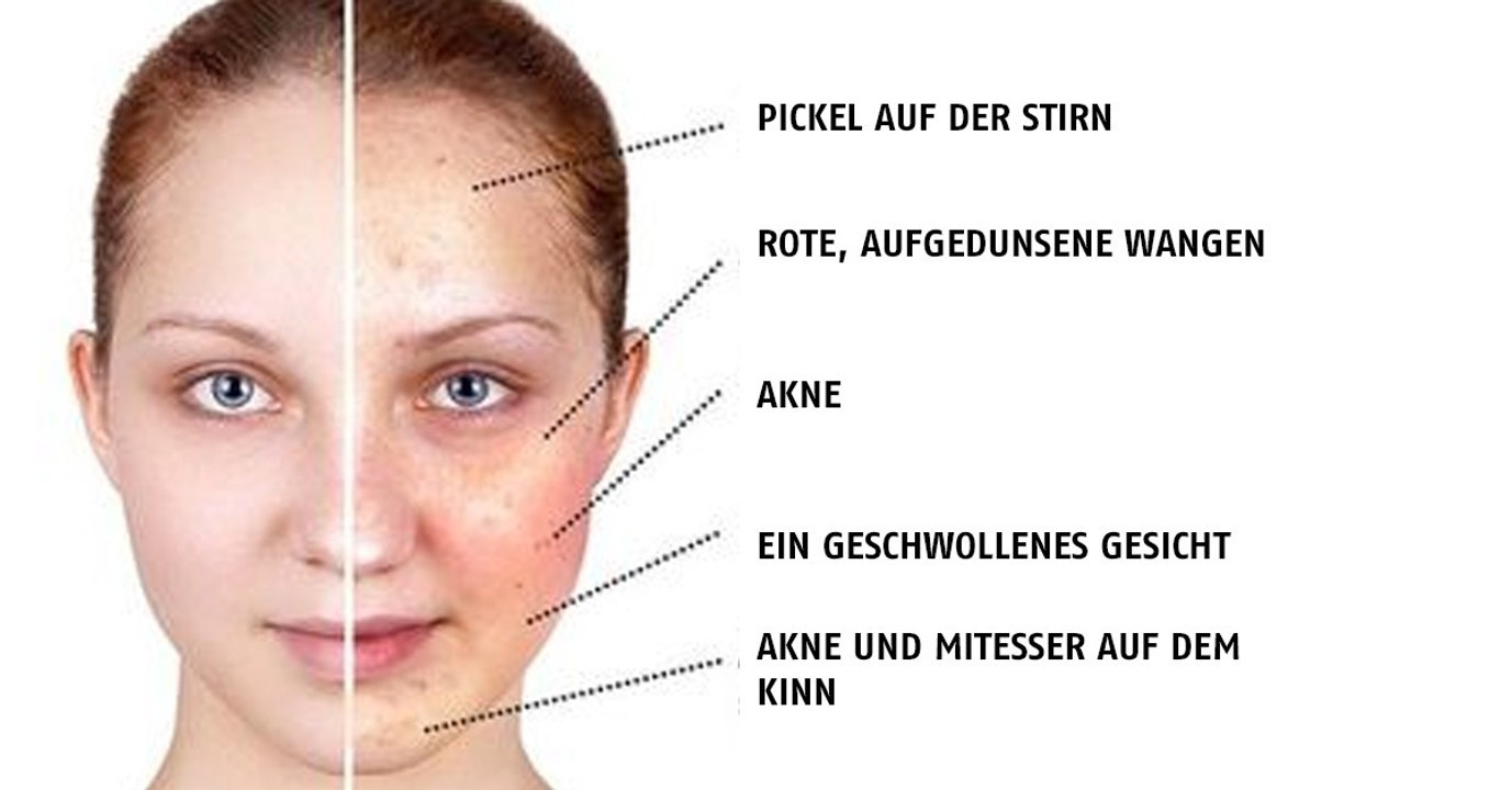 Das passiert mit eurem Gesicht, wenn ihr von diesen Lebensmitteln esst! Besser wenn ihr Bescheid wisst