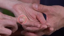 Akkupressur: Dieser Punkt an deiner Hand hilft bei Bluthochdruck