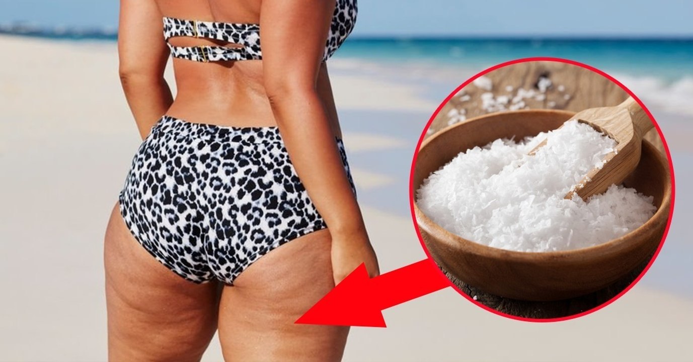 Die beste Schönheitskur, um Cellulite auf ganz natürliche Weise loszuwerden
