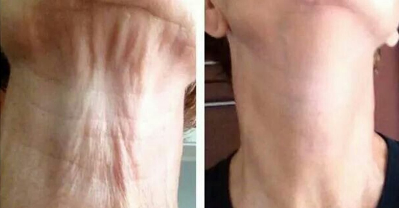 Mit diesem Trick bleibt eure Haut schön straff