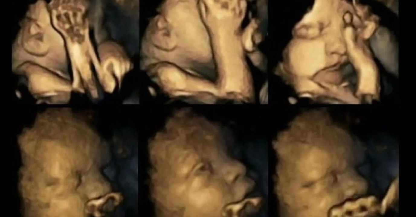 Erschreckende Bilder aus dem Mutterleib: So verhalten sich Föten, wenn die werdende Mutter raucht