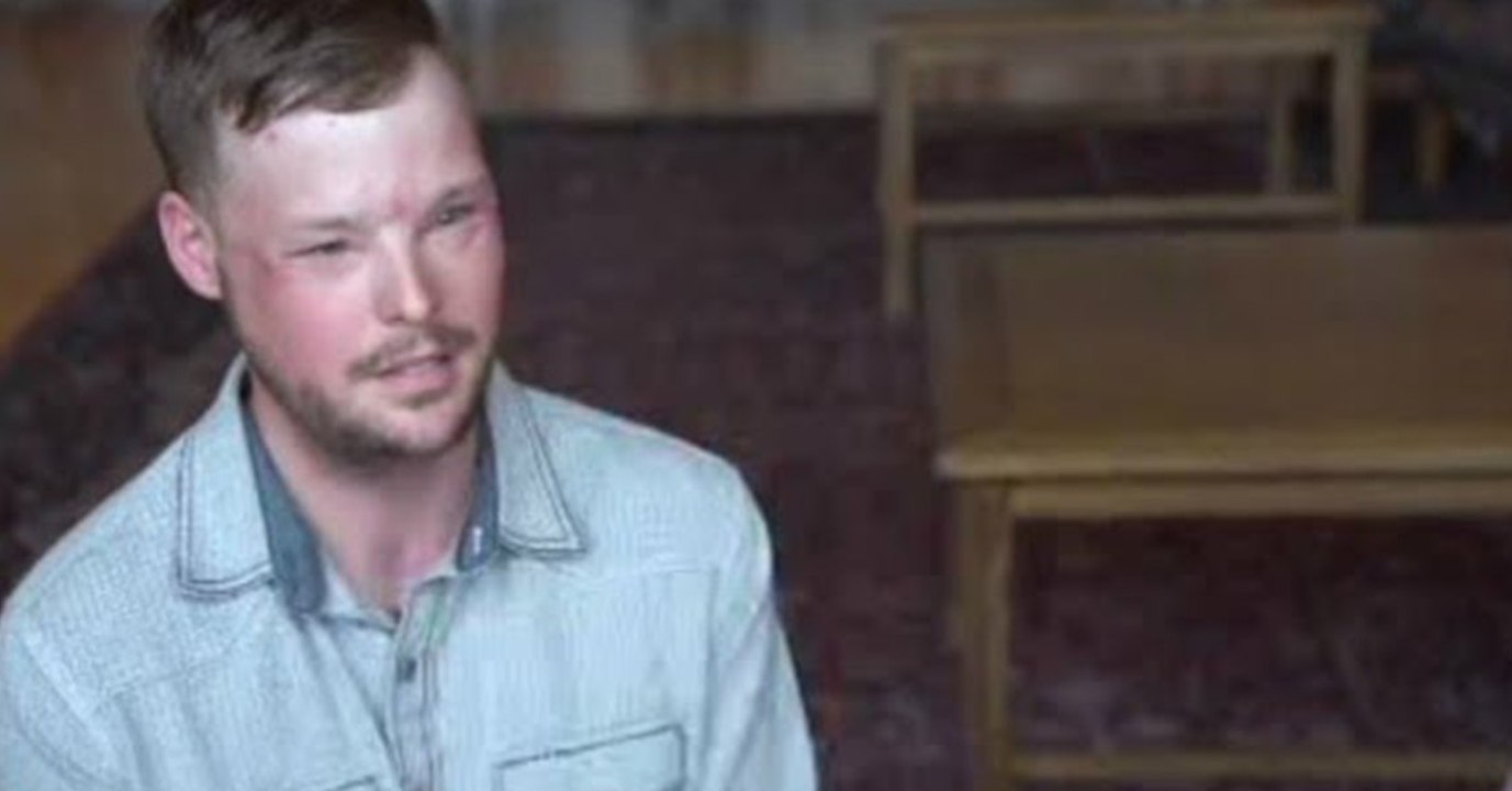 Dieser Mann hat ein neues Gesicht. Hier trifft er zum ersten Mal die Frau des Spenders