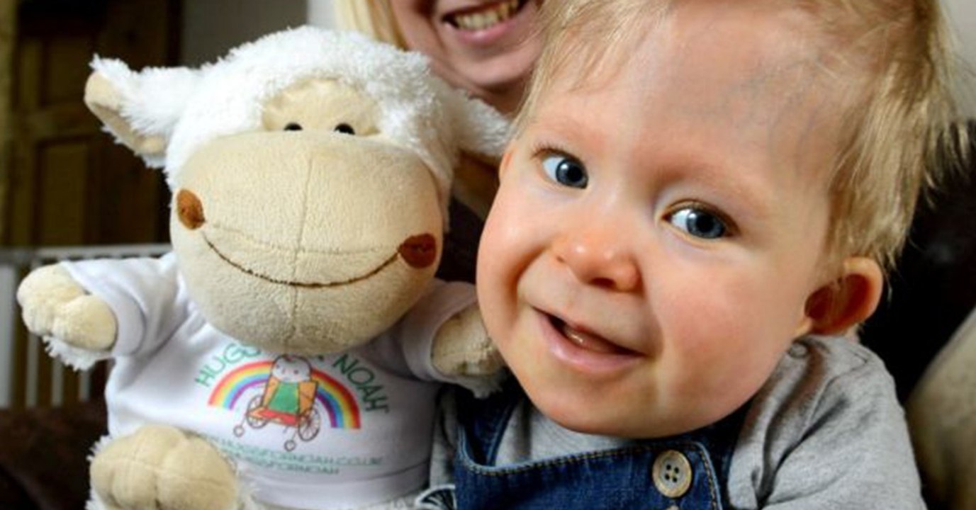 Er wurde fast ohne Gehirn geboren. So geht es ihm 5 Jahre später