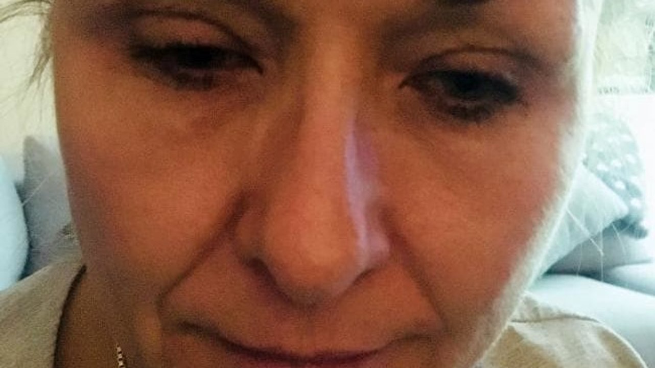 Sie schminkt sich 25 Jahre lang nicht ab. Dann geht sie zum Arzt und bekommt die Diagnose!