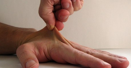 Kein Geld für einen Arzt-Besuch? Dieser Trick ist die Lösung!