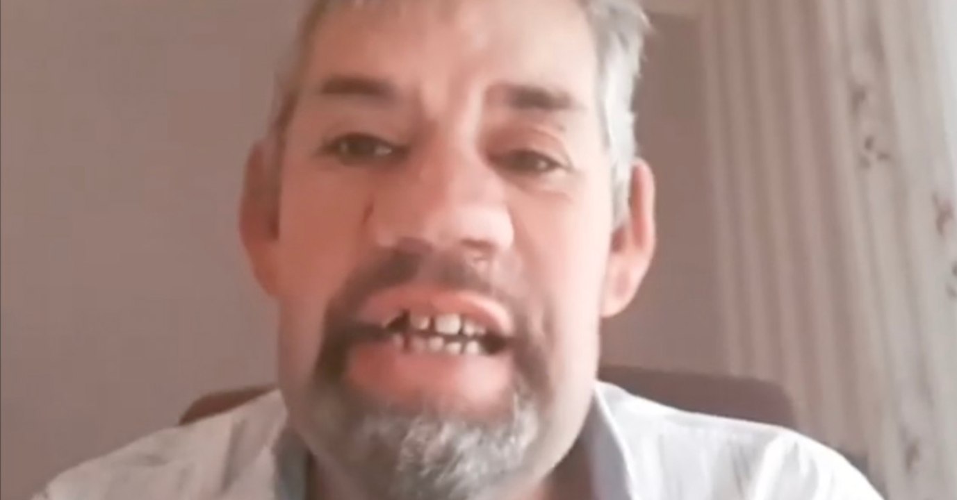 Wie im alptraum: bauer uwe verliert alle zähne!