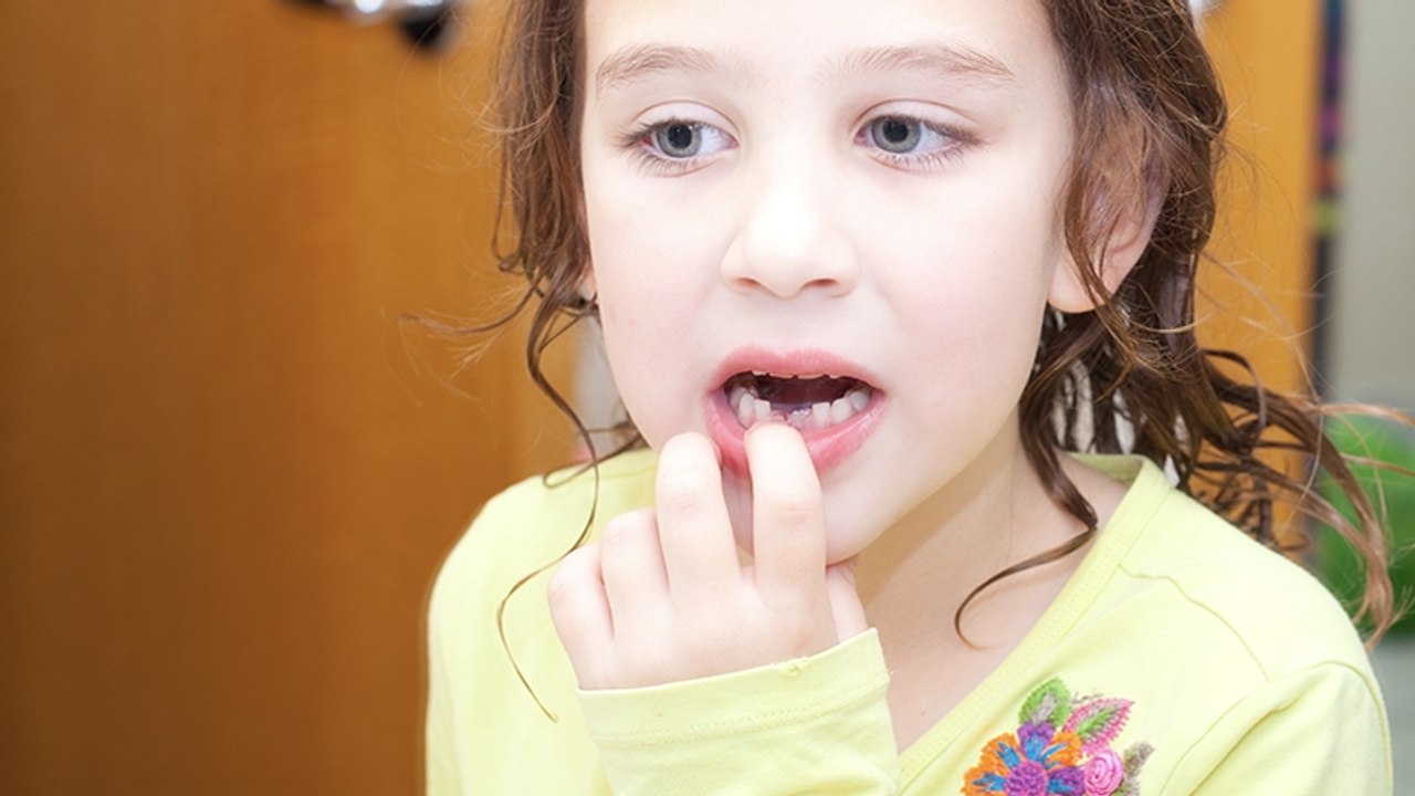 Wackelzähne können in der Nacht zur Gefahr werden: Dieser 9-Jährigen wird einer zum Verhängnis