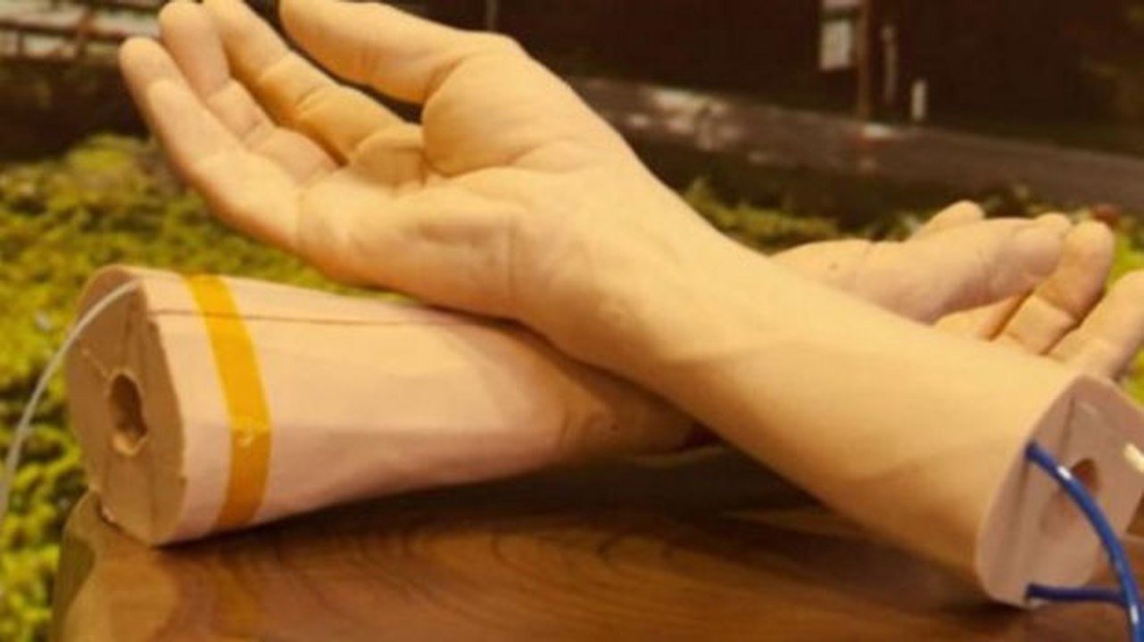 Google entwickelt ein Armband zur frühzeitigen Krebsdiagnose