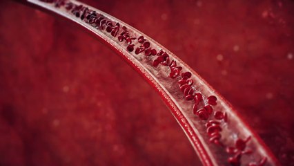 Verstopfte Arterien: Diese 6 Anzeichen solltet ihr nicht unterschätzen!