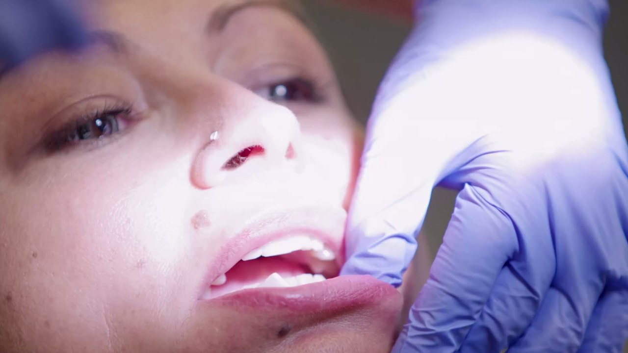 Schock-Garantie: Diese Frau hat die größten Lippen der Welt